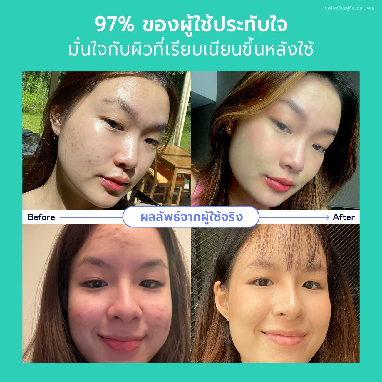 3.3 Skincare Ultimate Set