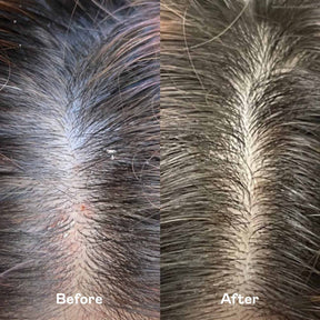 Christmas Haircare Gift Set