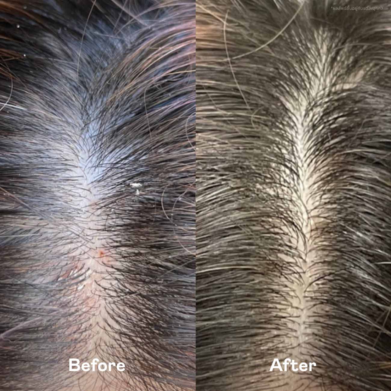 Scalp Balance Duo Set